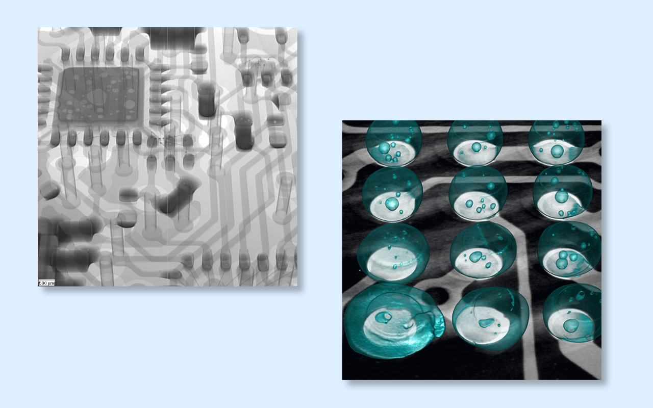 4. 2D vs 3D CT X-ray Which One Do You Really Need? 4. 2Д вс 3Д ЦТ рендгенски снимак који вам је заиста потребан?