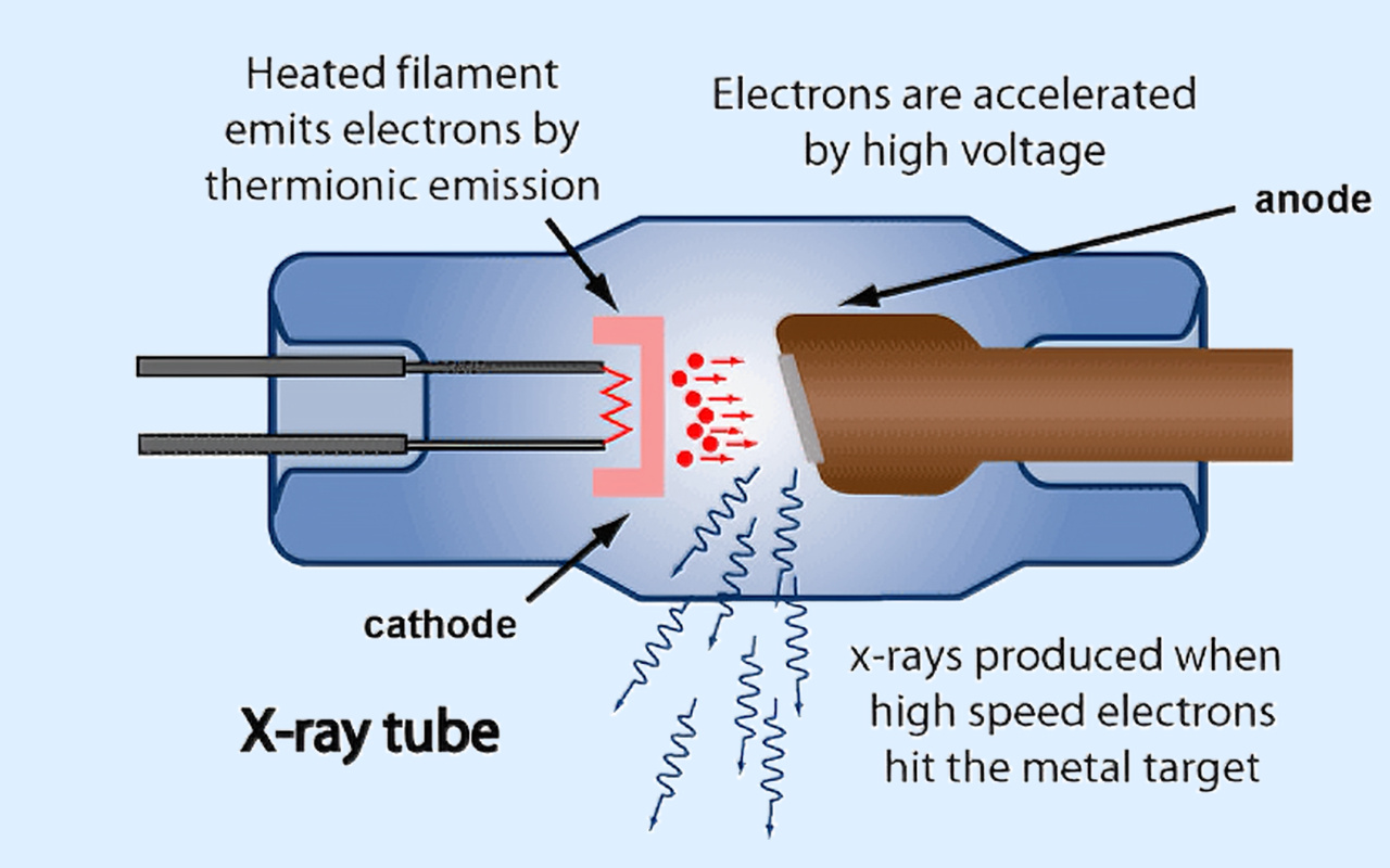 2. What X-ray Technology Actually Does 2. Шта рендгенска технологија заправо ради